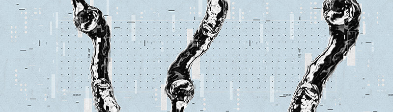 Can Men Squirt? A Guide to Male Squirting